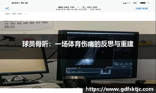 球员骨折：一场体育伤痛的反思与重建